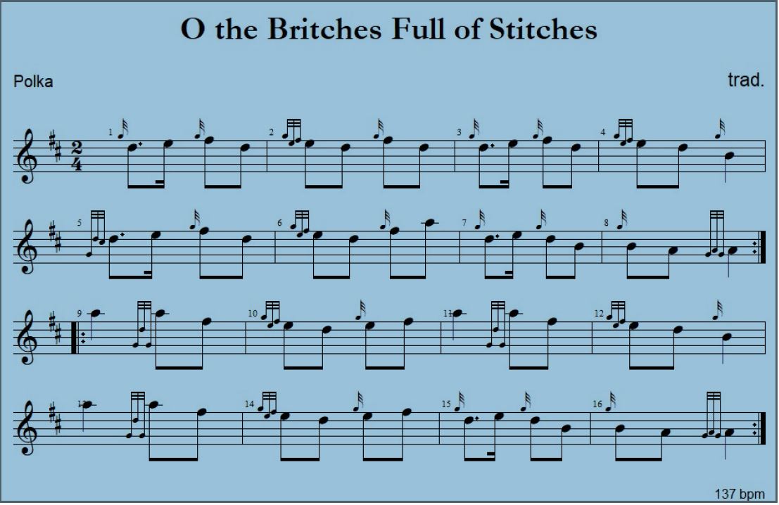 BritchesFullOfStichesMitDudelsack.JPG