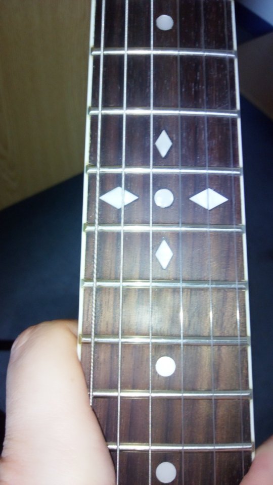 inlays.jpg