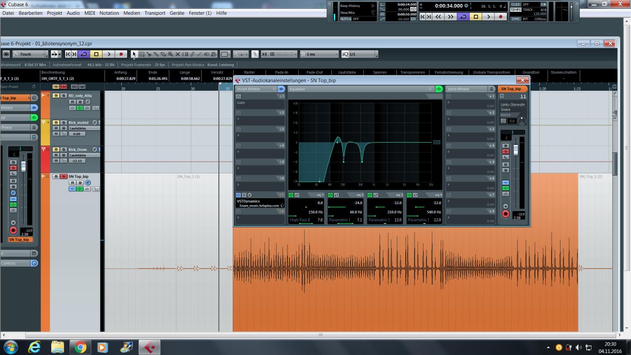 Snare_TOP.jpg