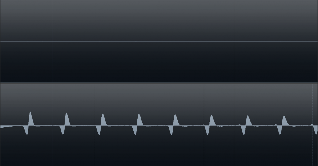 Übersprechen3.png