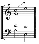 Vorhalte-Sigal.jpg
