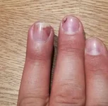 IMG_20181115_185858.jpg