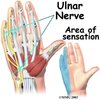 hand_anatomy_nerves041.jpg