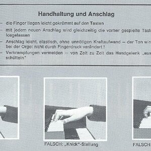 Fehlstellung der Hand.jpg