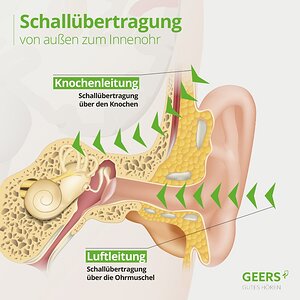 20150205-knochenleitung.jpg