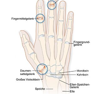 Fingergrundgelenk.jpg