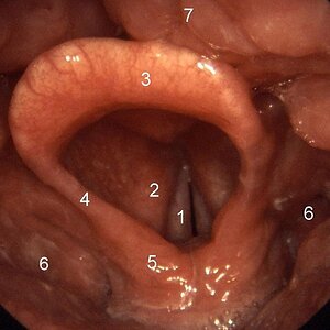 Larynx_normal.jpg