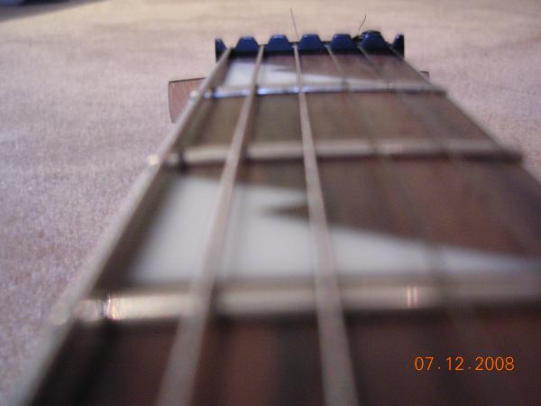 Inlays