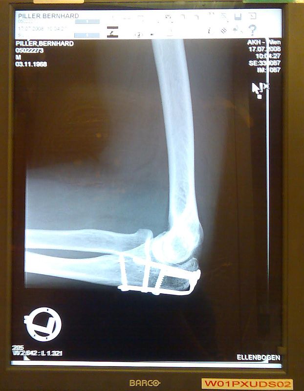 xray.jpg